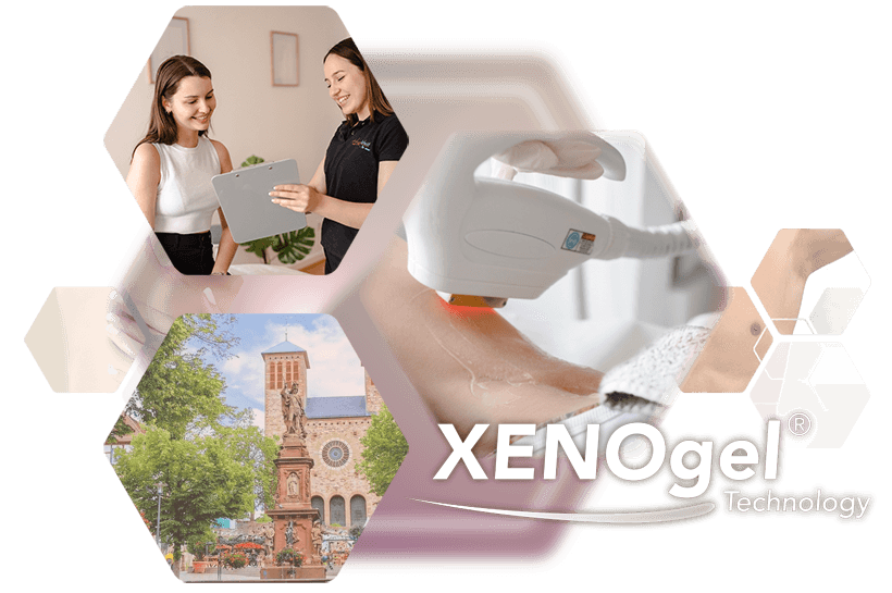 Fotokollage bester Service beste Technik XENOgel Technologie in Bensheim