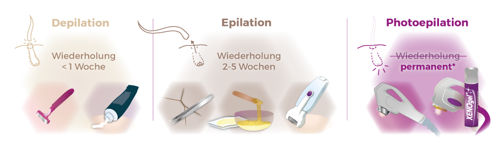 Infografik Vergleich Depilation Epilation Photoepilation