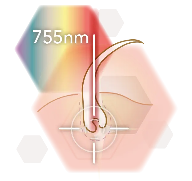 Infografik Wellenlänge 755nm Alexandritlaser
